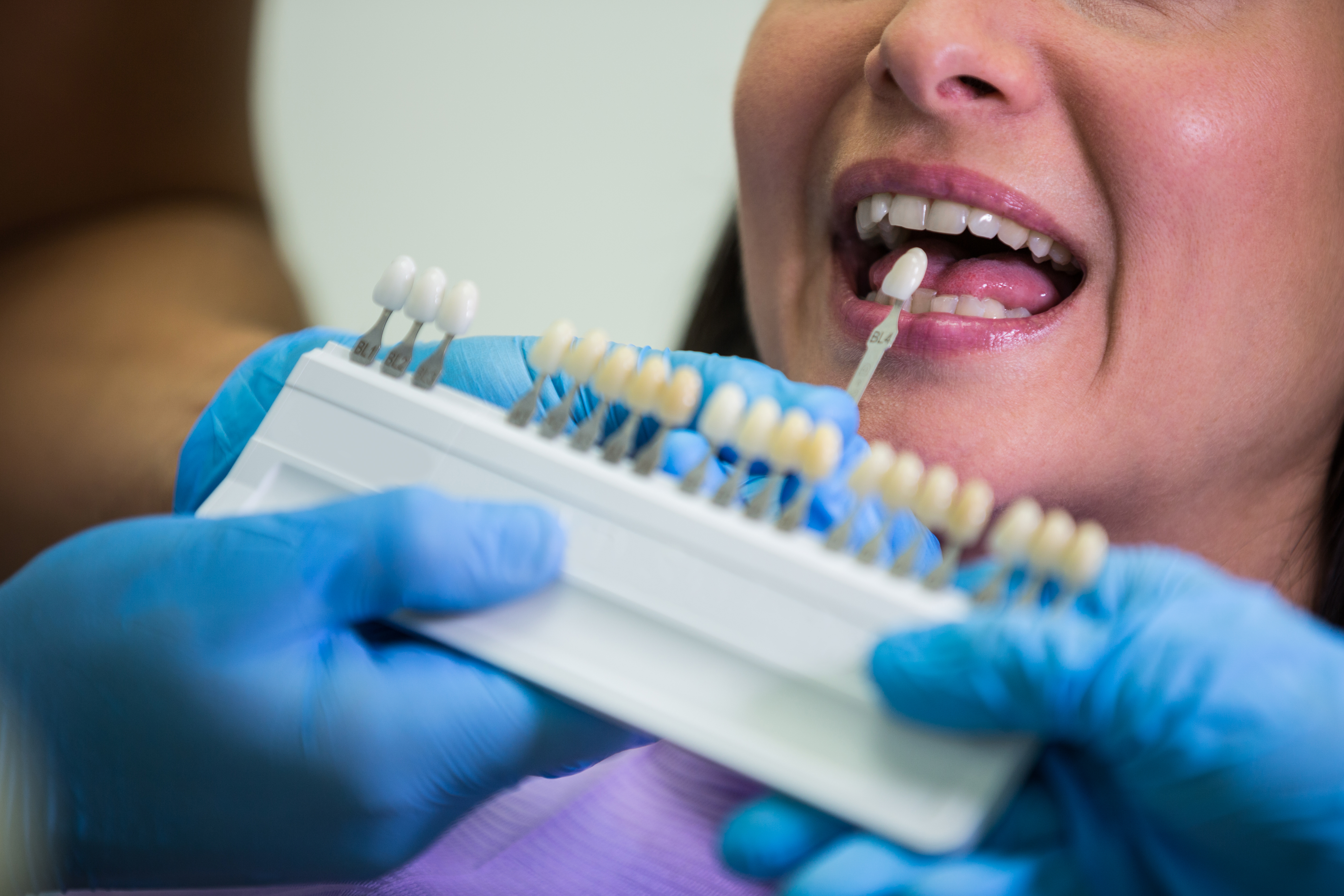 Orthodontic treatment